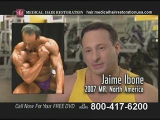 Get the Best Hair Loss Treatment in Cleveland