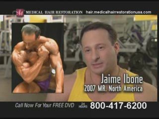 Get Hair Transplantation in Cleveland