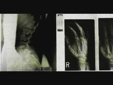 Alien's Rise Up - Electric #composition kiev.