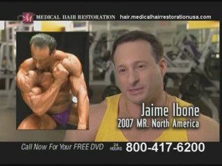 Get Hair Transplant Surgery in San Diego