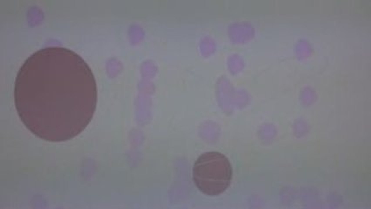 La chute vs Le soutien