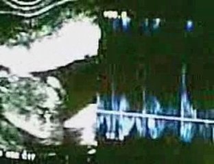 FILM échographie du 09 mars 2009.