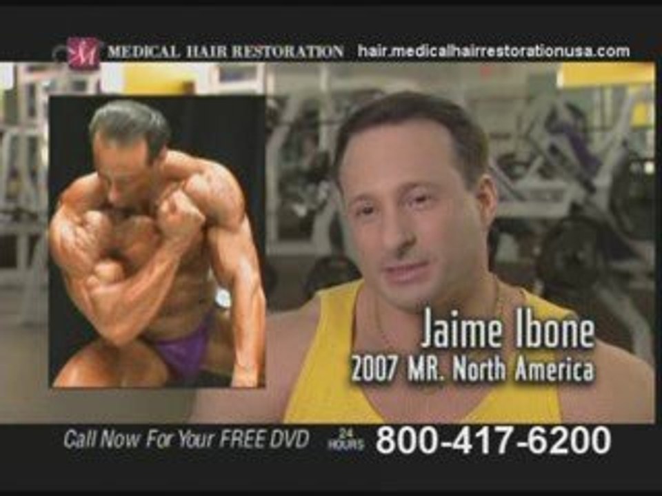 Get Hair Replacement Surgery in Minnesota