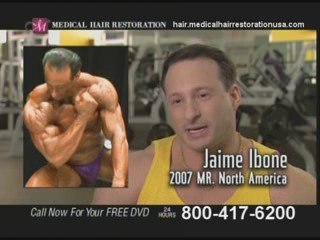 Get Hair Replacement Surgery in Chicago