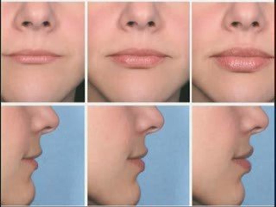 The Merz Scales First Scales to Measure Skin’s Agin...