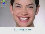 Alpharetta-Invisalign-braces-Orthodontist-Teen-Adult