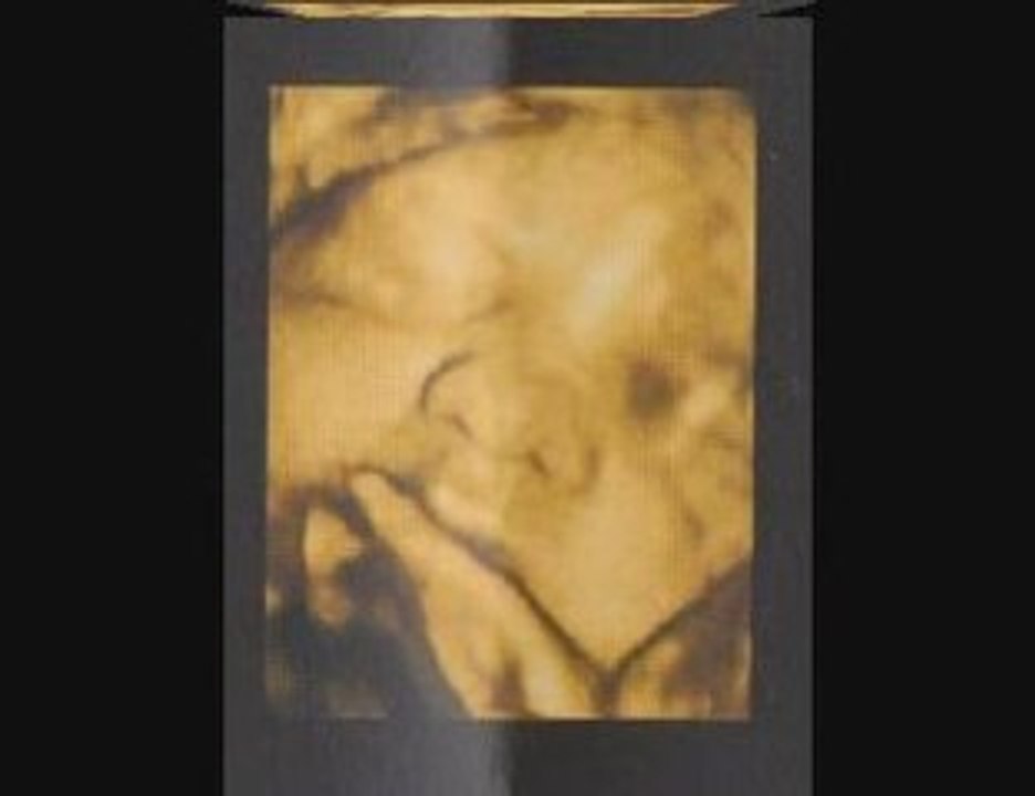 Petite soeur in utero