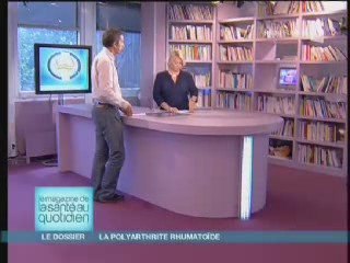 Polyarthrite rhumatoïde