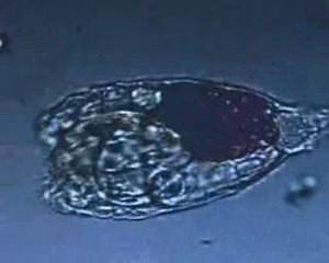 Virus (nothing will ever get better)