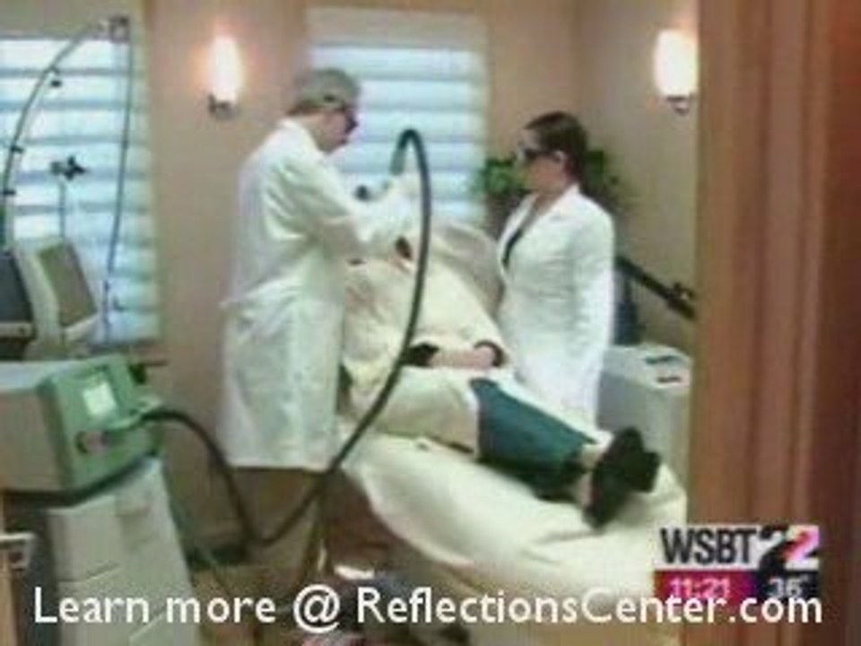 Chemical Peel without the harsh chemicals?