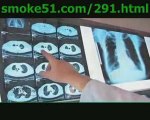 Smoke51 Electronic Cigarette Health Benefits