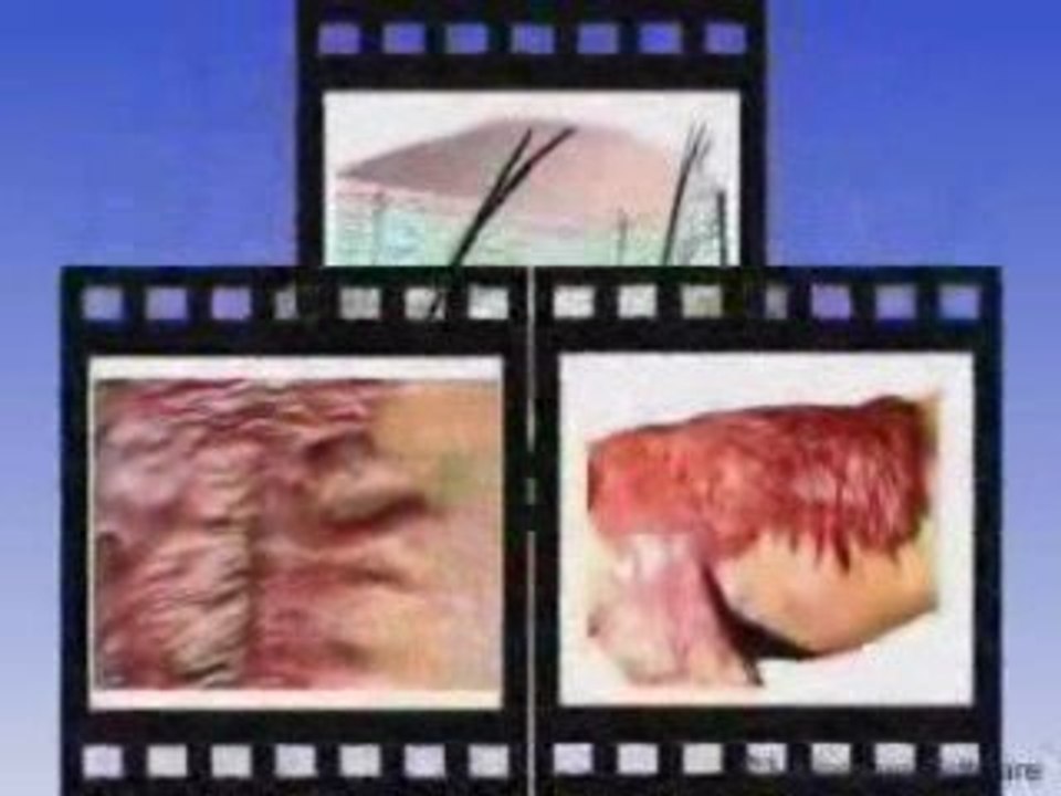 La peau et la sensibilité(miracle coranique)