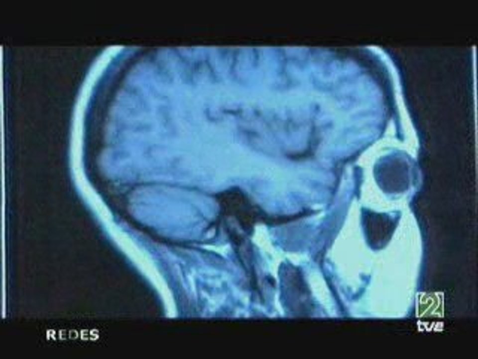 Testosterona y agresividad
