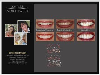 Beaverton Oregon Dentist Dr. Alan Montrose DDS