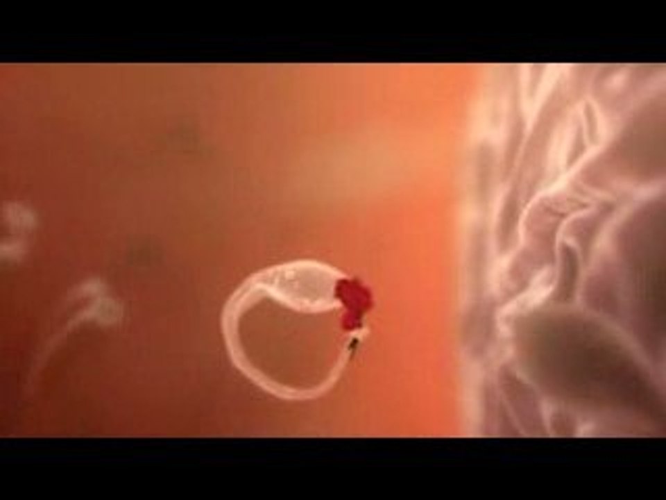 Spermatozoides