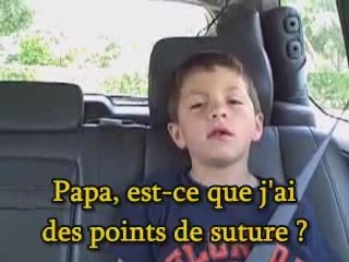 Après l'anesthésie du dentiste...