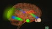 Cerebro emocional: Amigdala