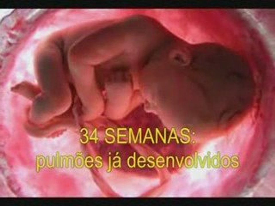 Assim que Tudo Começa