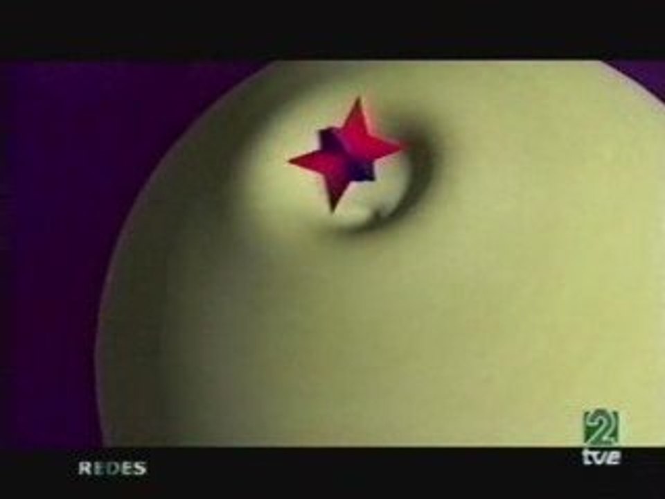 Enfermedades autoinmunes