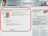 Ask a Dental Implants Dentist about Mini Dental Implants