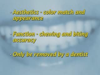 Dental Patient Education - Bridge