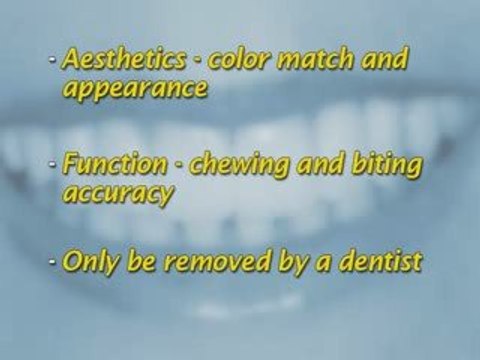 Dental Patient Education - Bridge