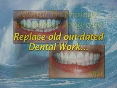 Infostar Dental Patient Education DVD Presentation