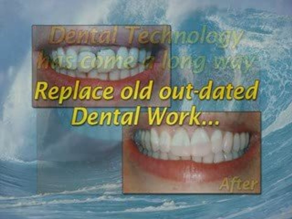 Infostar Dental Patient Education DVD Presentation