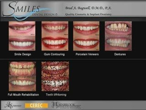 Cosmetic Dentistry by Cocoa Dentist Dr. Brad Bagwell