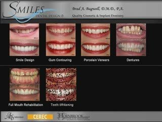 Cosmetic Dentistry by Cocoa Dentist Dr. Brad Bagwell