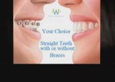 Duluth Invisalign Braces-In-Motion Walton Orthodontics