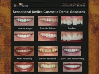 Laguna Nigel California Dentist Dr. Norman Huefner DDS