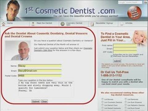 Ask a Cosmetic Dentist about Porcelain Veneers