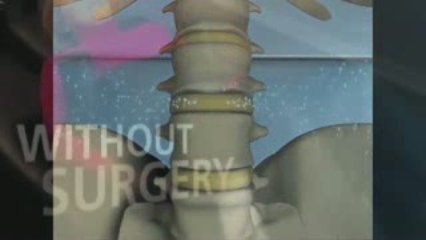 Vancouver - Coquitlam - Chronic Neck & Back Pain