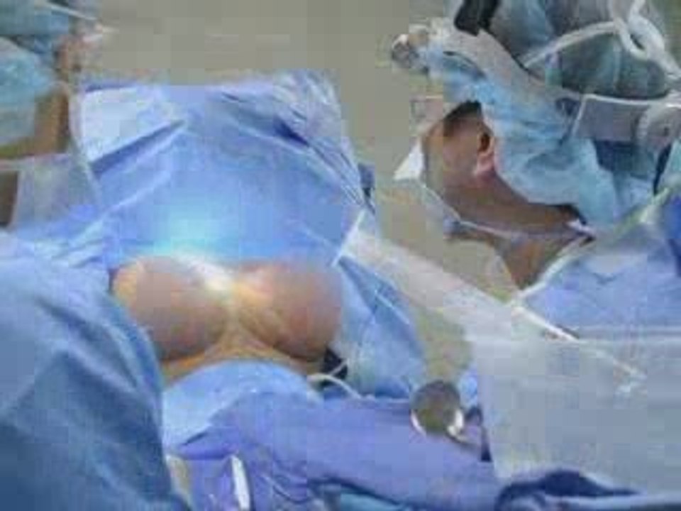 My Breast Augmentation & Rhinoplasty