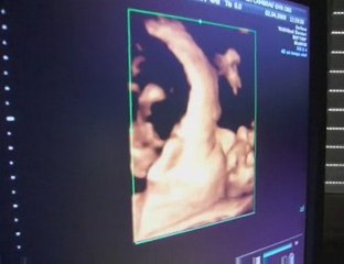 Bébé en trois ou quatre dimensions