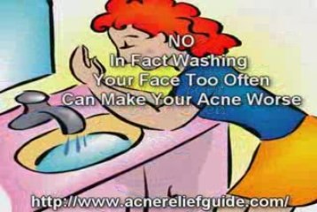 Acne Myths - Do You Know The Truth About Them