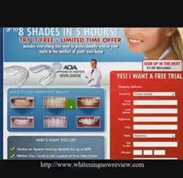 Best Teeth Whitener- The Top Product For Best Teeth Whitener