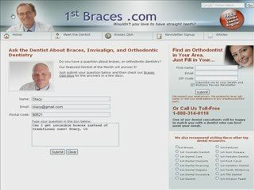 Ask a Braces Dentist about Invisalign Braces