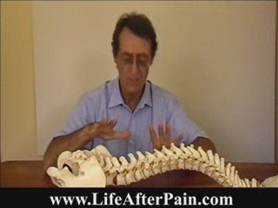 How Prolapsed and Herniated Discs Cause Sciatica