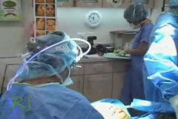 Safety & Risks of Nose Surgery Presented by Dr. Paul Nass...