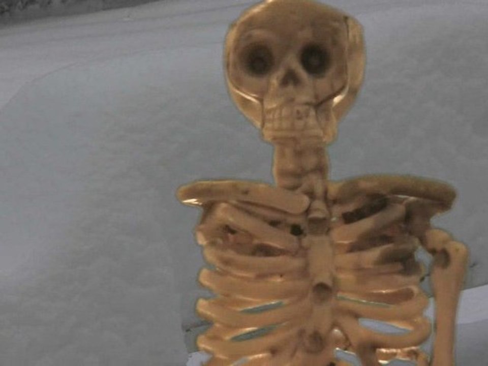 Skele4Christ Jesus Demands All