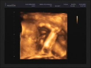 Echo affective petit Leny