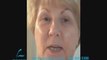 DALLAS FACE LIFT FACELIFT FAT TRANSFER 3 WEEK DIARY