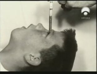 Howard Dully: Lobotomizado a los 12 años