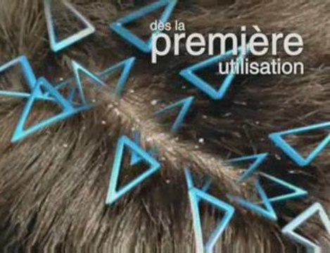 Head-shoulders-zinc-perytionne