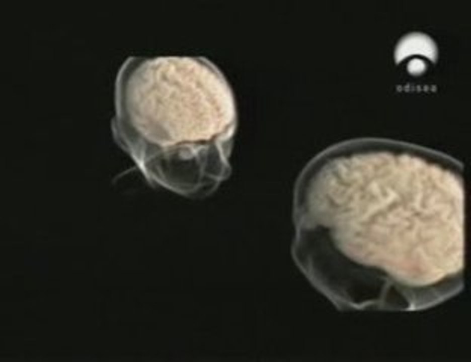 Cerebro: Diferencias de genero