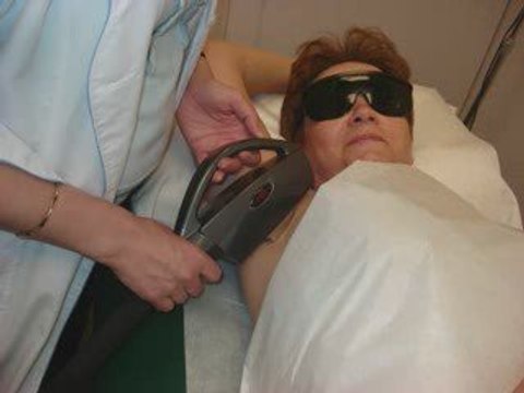 Laser Hair Removal Underarm