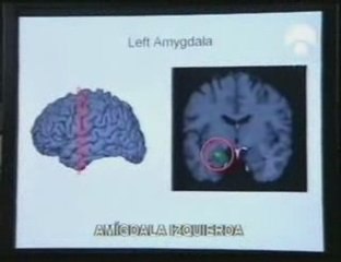 Amigdala y emociones: Rostros desfigurados (RMf)