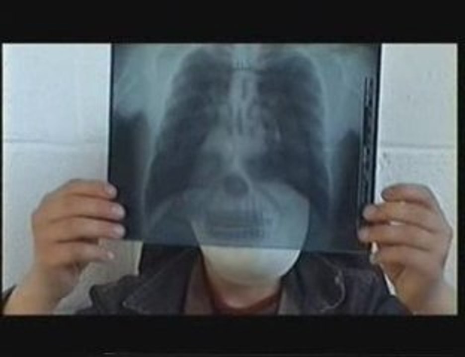 Le Foya EESSCF Anderlues